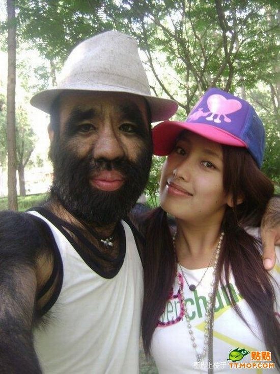 Which country has the hairiest women